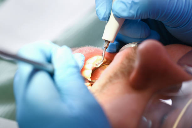 Best Urgent Dental Care  in Hillsville, VA